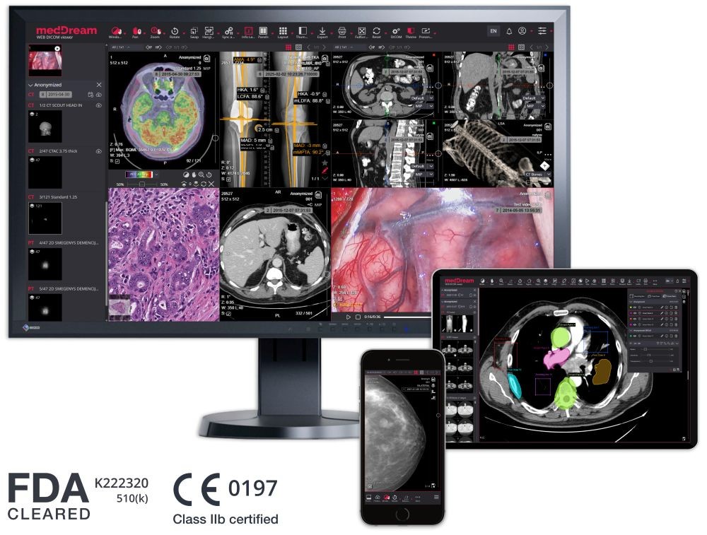 Web based DICOM viewer - MedDream
